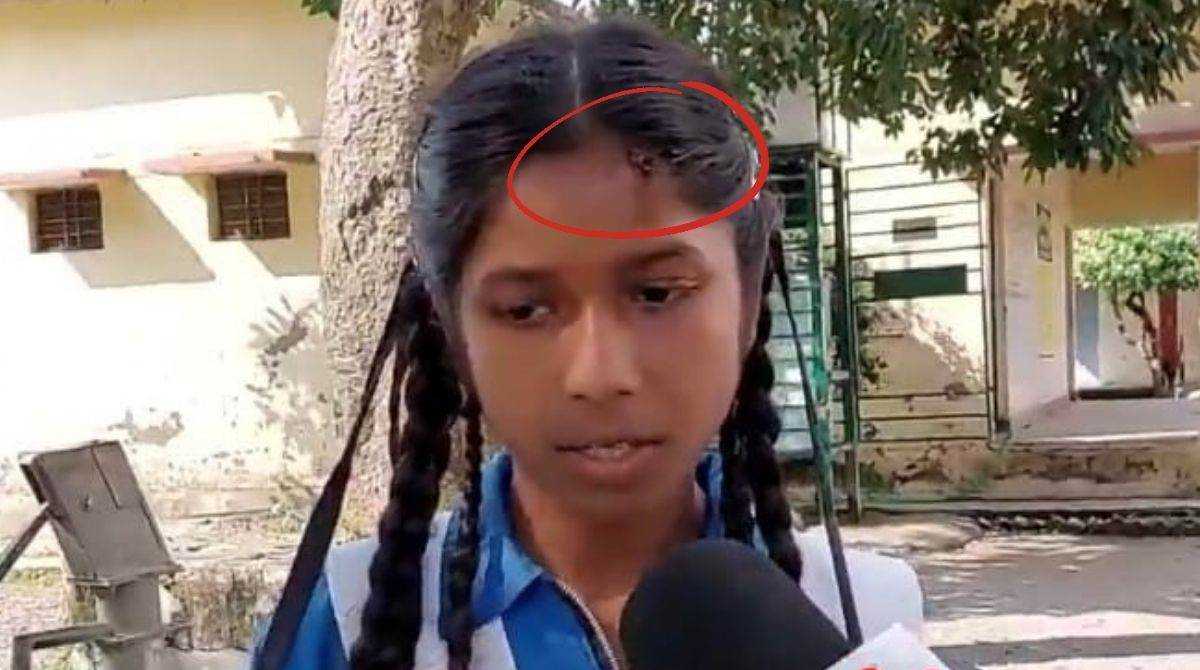 उधमसिंह नगर में शिक्षक ने 12वीं छात्रा का सिर फोडा, अभिभावकों में उबाल…