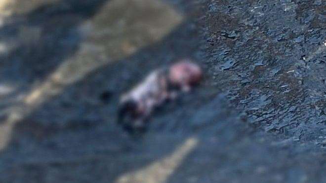 five month old fetus